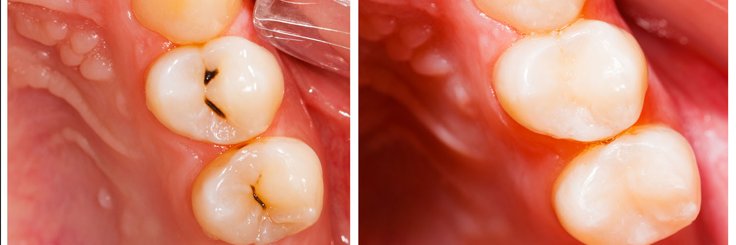Wayne Syn, DDS